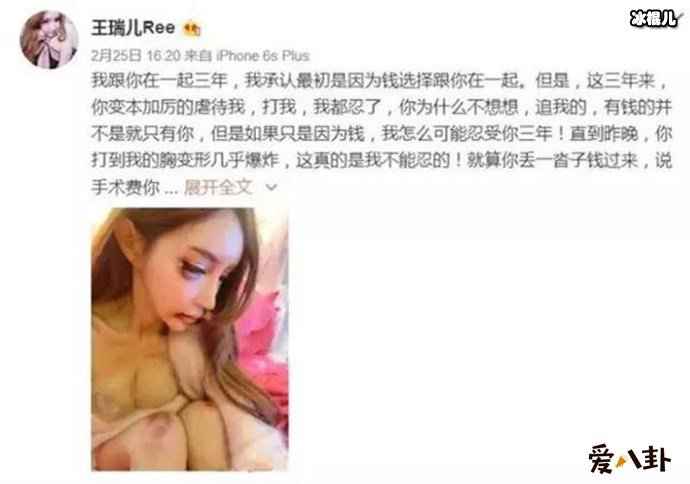 张爱朋前女友控诉张爱朋家暴