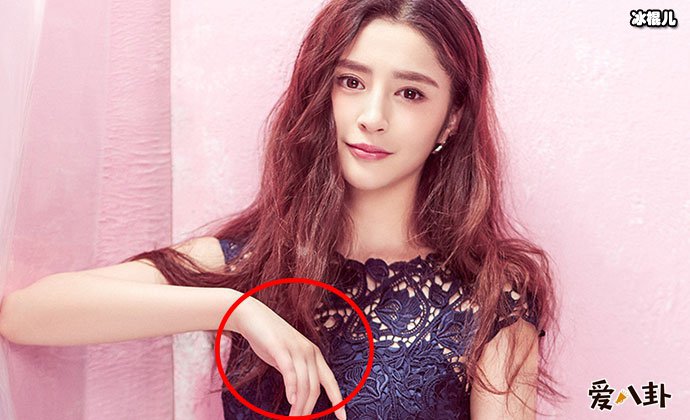 李心艾的手怎么了