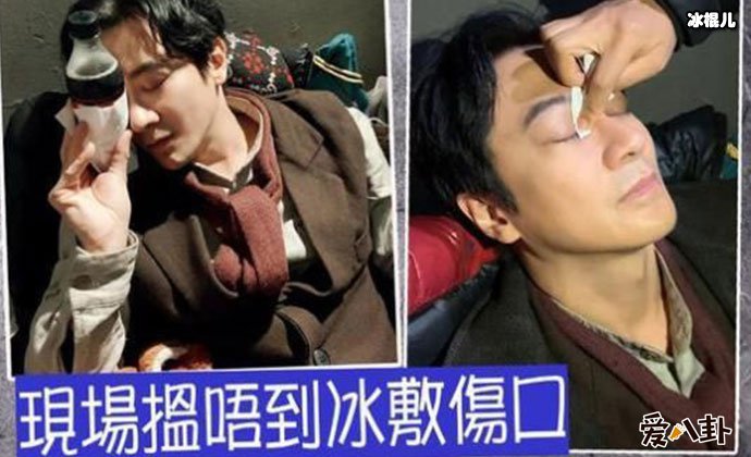 孙耀威被打伤眼角