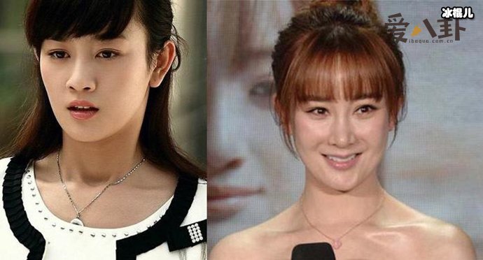 张檬晒全素颜照谈整容