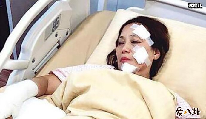 杨盼盼片场烧伤怎么回事