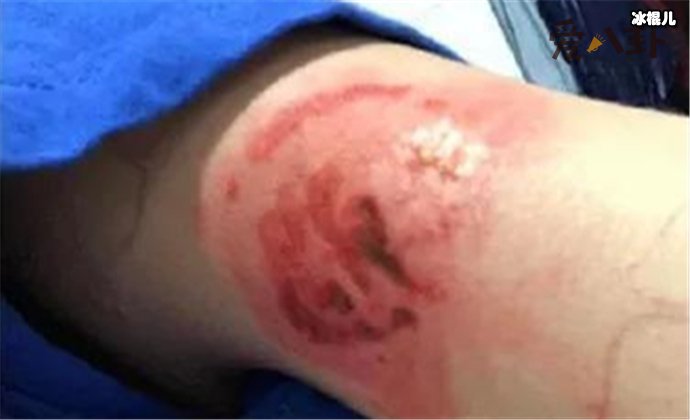 左婧媛晒被打照片