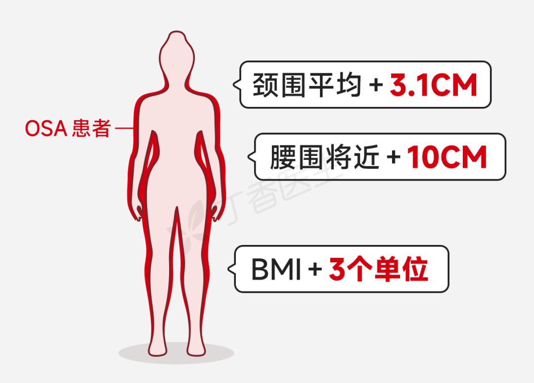 阻塞性睡眠呼吸暂停综合征_打鼾如何治疗_ggbbm