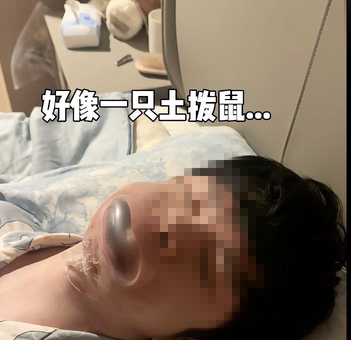 ggbbm_打鼾如何治疗_阻塞性睡眠呼吸暂停综合征